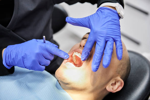 Best Root Canal Emergency Dentist  in Parklawn, CA