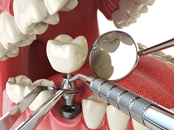 Best 24-Hour Emergency Dentist  in Parklawn, CA